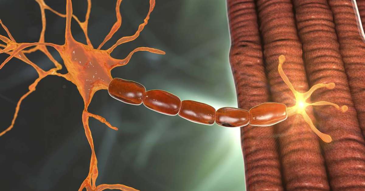 Miastenia Gravis: A Doença Silenciosa que Afeta os Mais Pobres