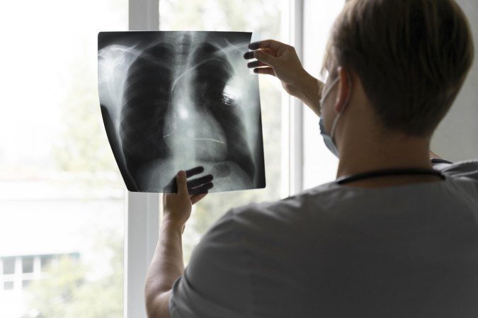 IA e luz natural do tecido: nova técnica promete acelerar tratamento do câncer de pulmão no SUS